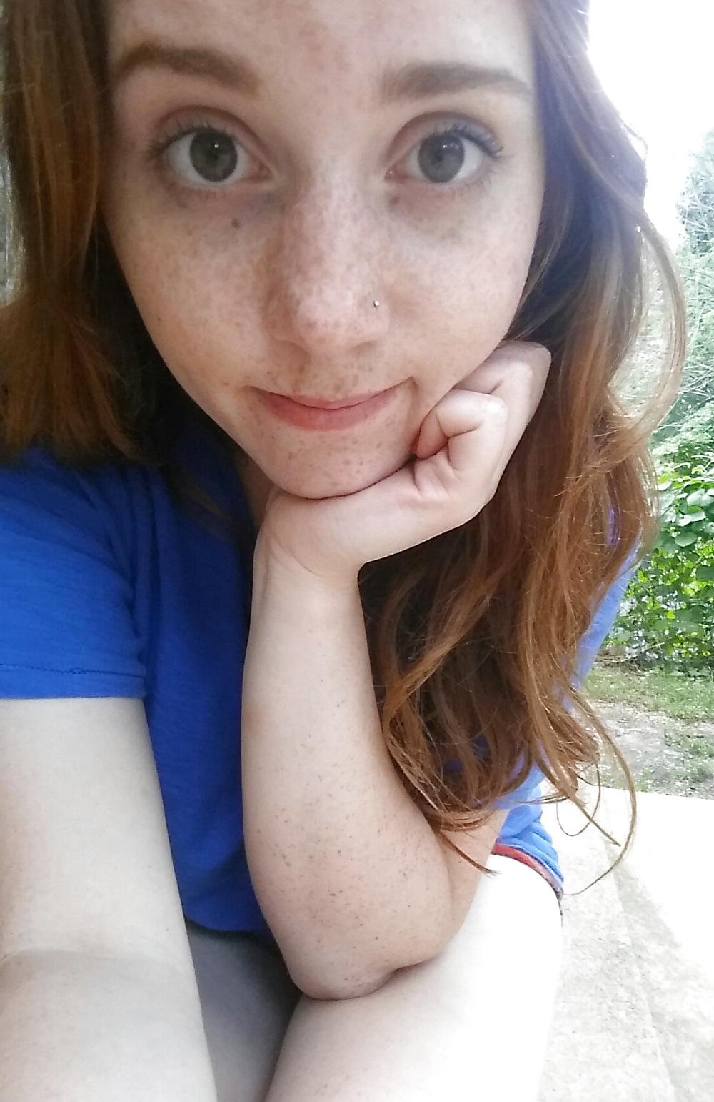 24P Freckled girls