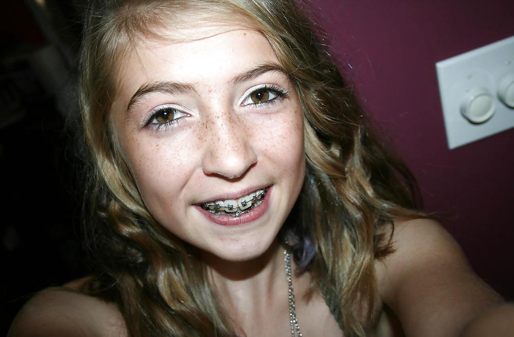 24P Freckled girls