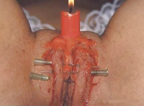 14P Pain as a rule of life.