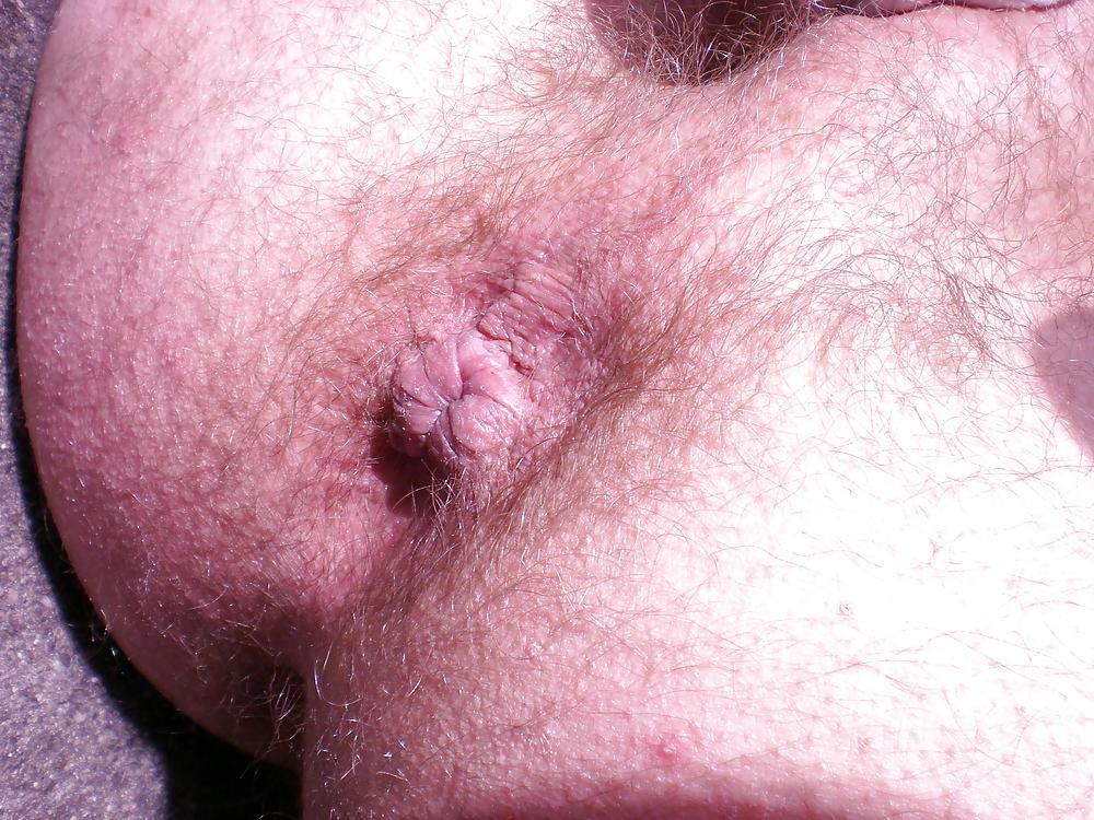 10P Dirty hairy ass