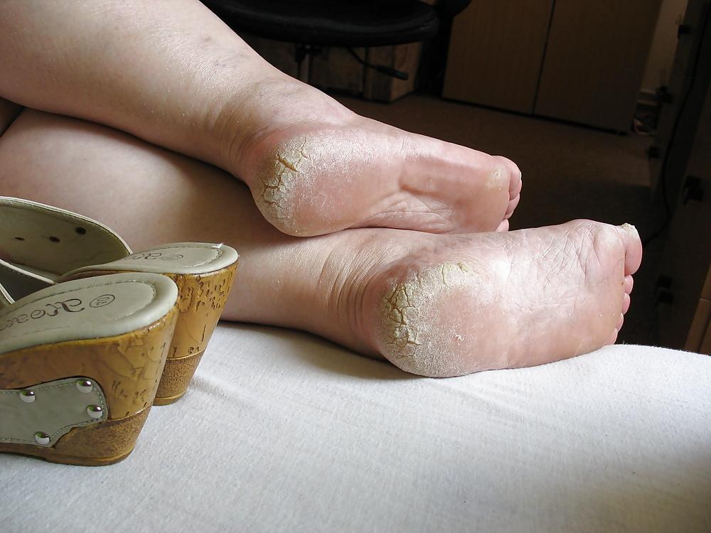 11P Feet: Dirty Soles #16