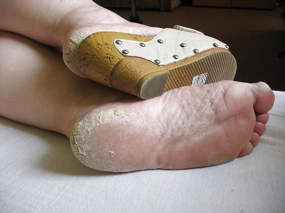 11P Feet: Dirty Soles #16