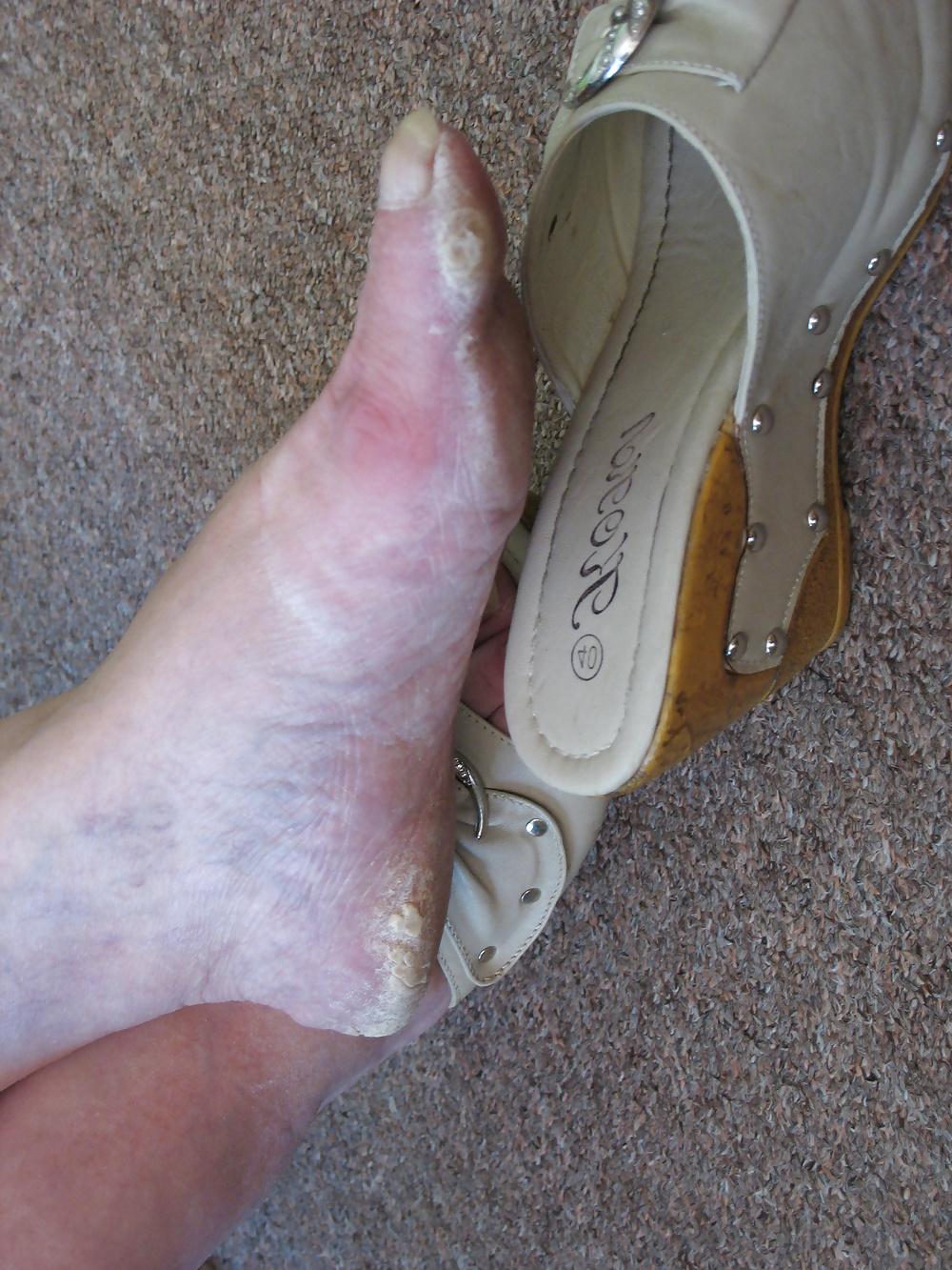 11P Feet: Dirty Soles #16