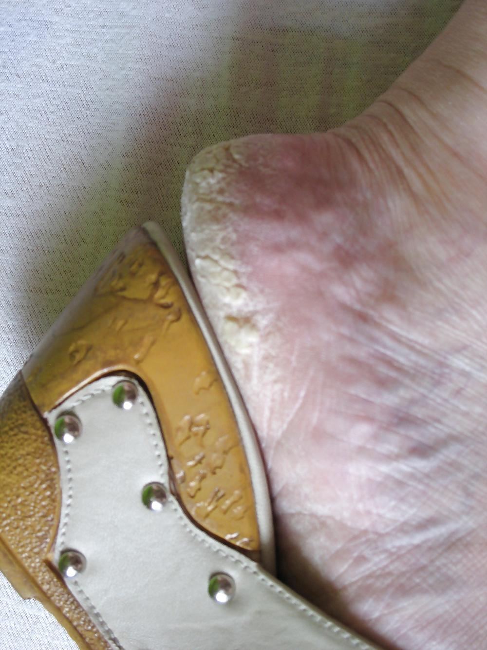 11P Feet: Dirty Soles #16