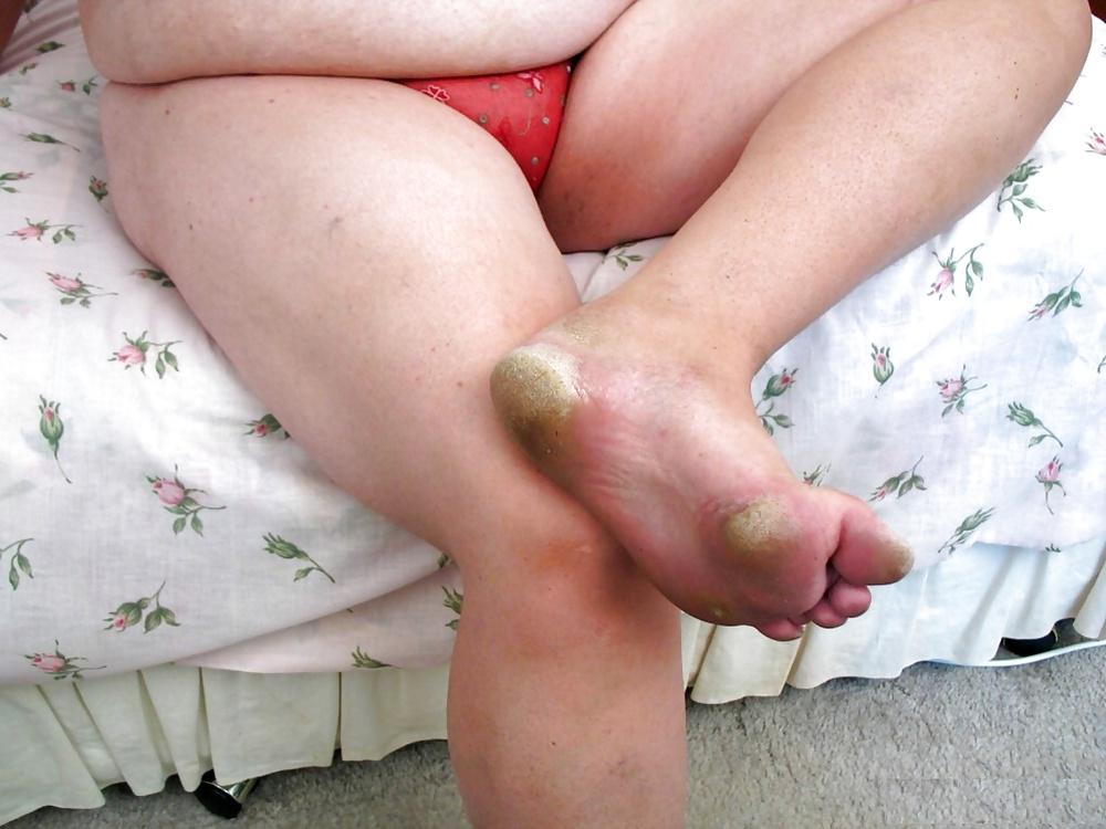 10P Feet: Dirty Soles #45