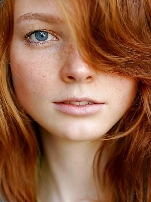 25P Freckled 3