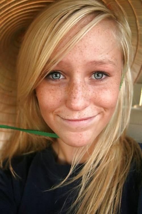 25P Freckled 3