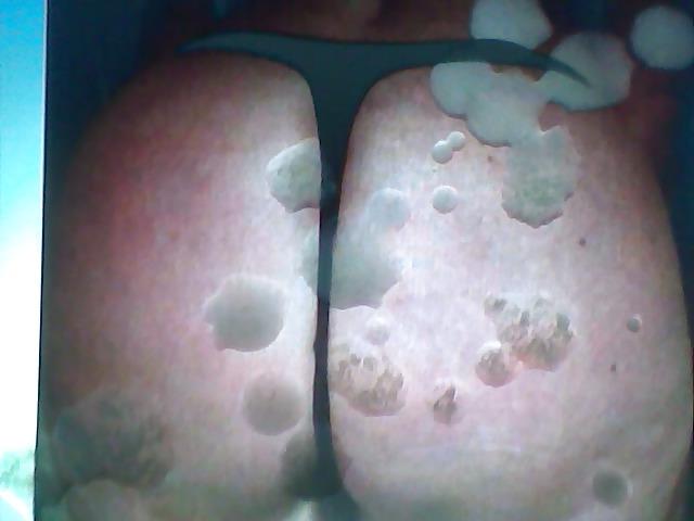 5P Cum of discusr6 geile reife frau