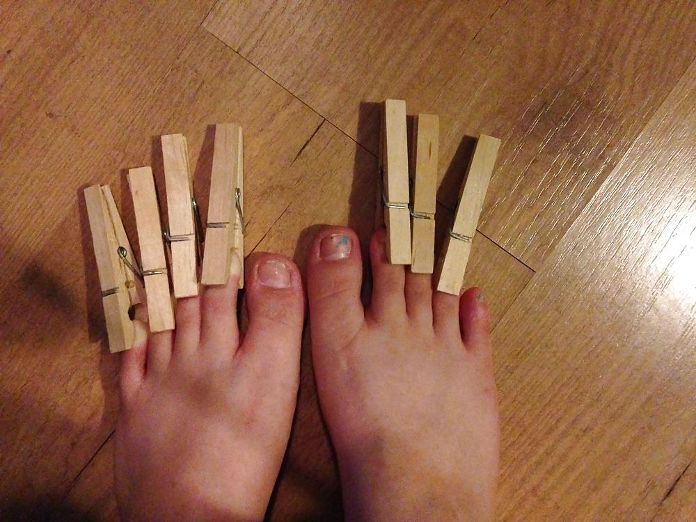 6P Toe or foot pain