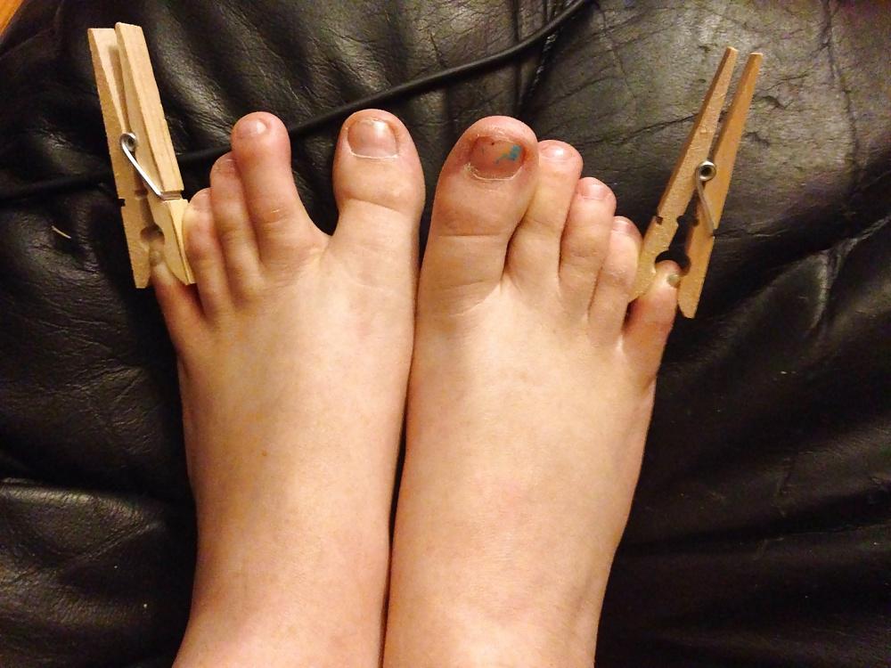 6P Toe or foot pain