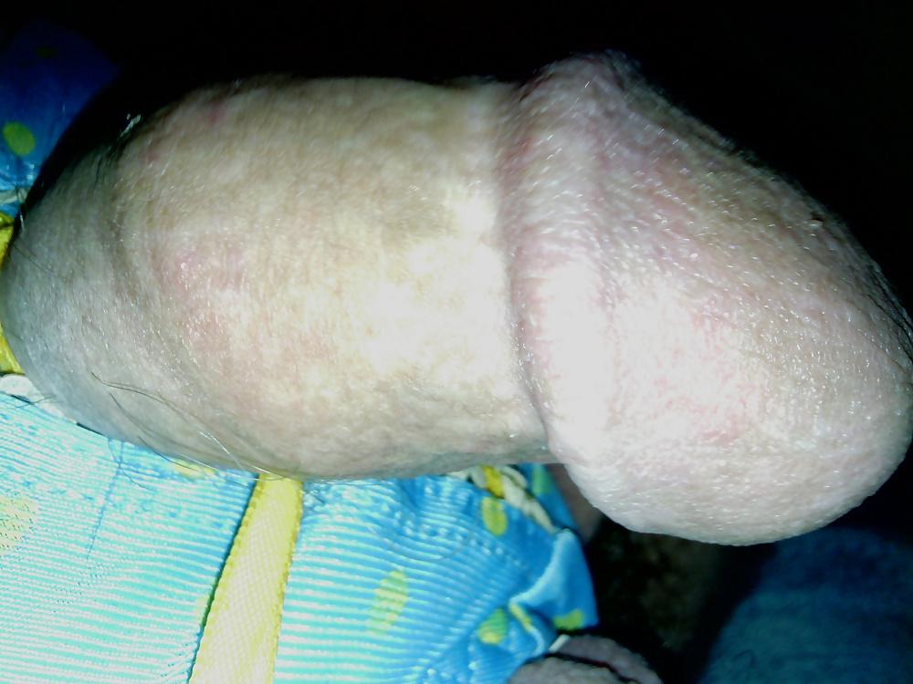 11P Cute little penis