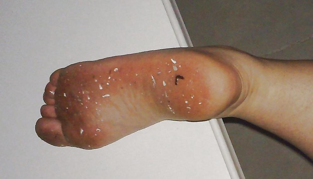 25P Feet: Dirty Soles #3