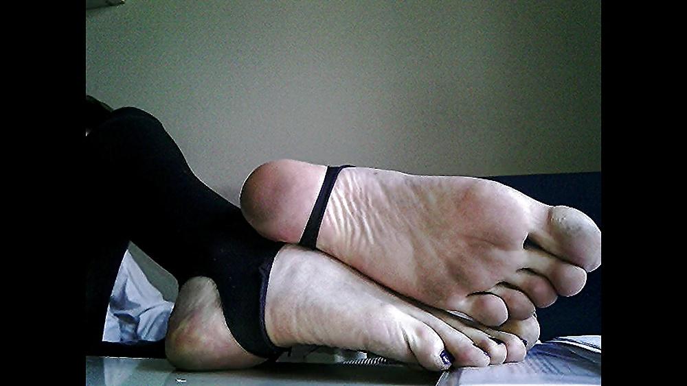 20P Blue toenails