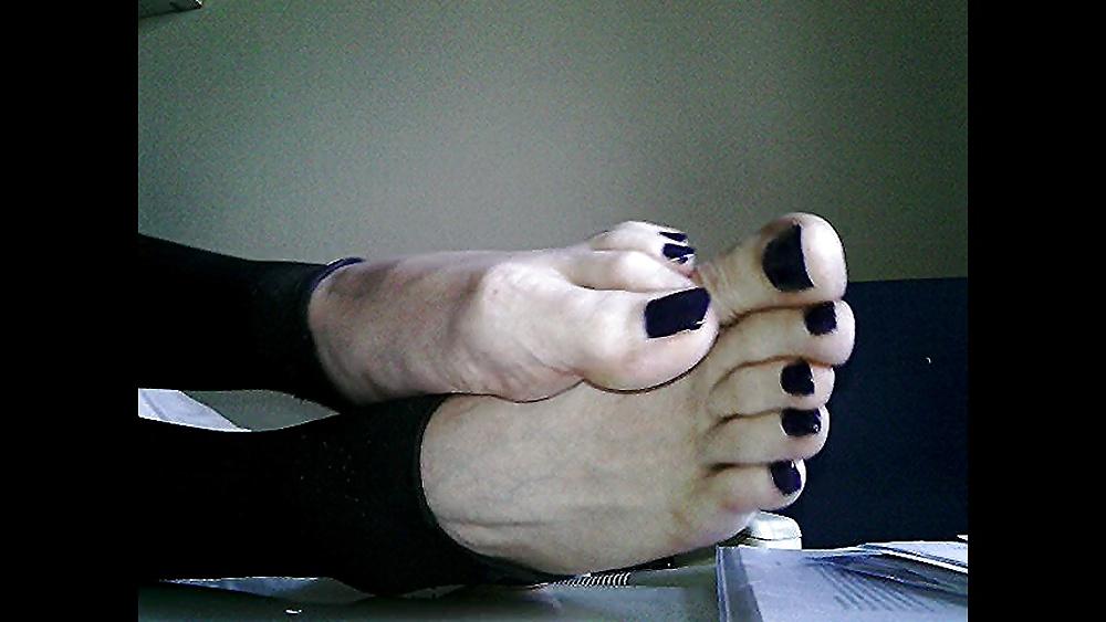 20P Blue toenails