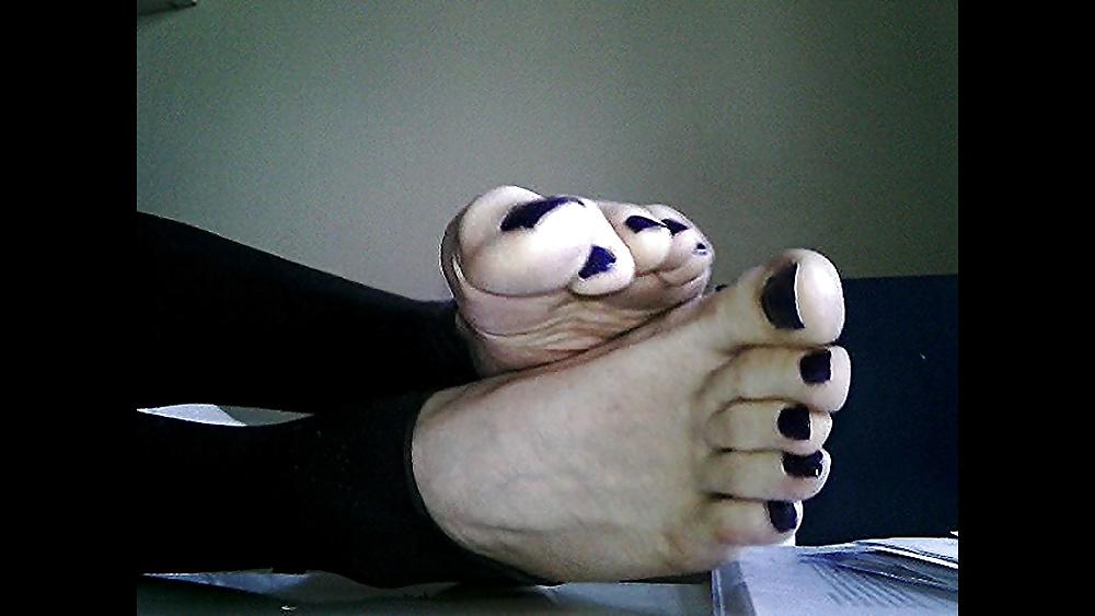 20P Blue toenails