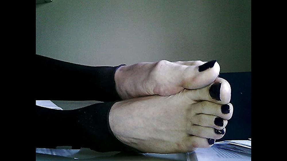 20P Blue toenails