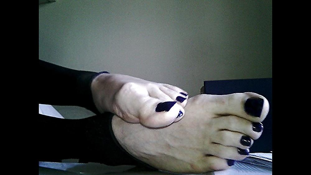 20P Blue toenails