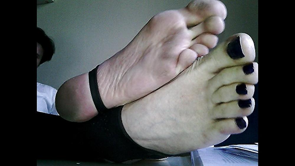 20P Blue toenails