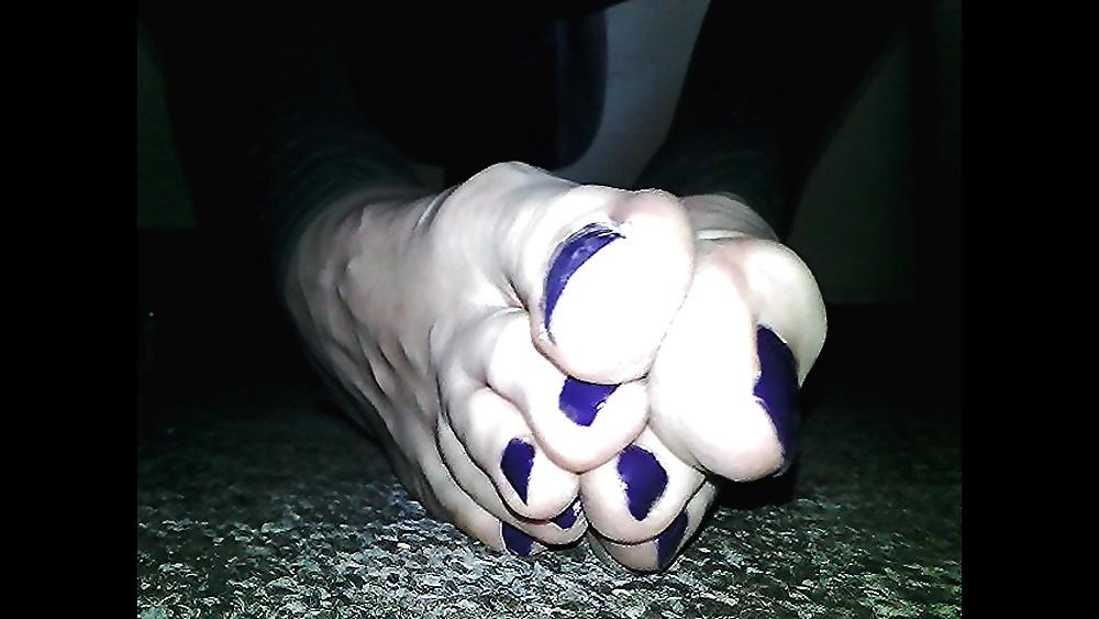 20P Blue toenails