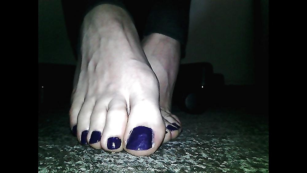 20P Blue toenails