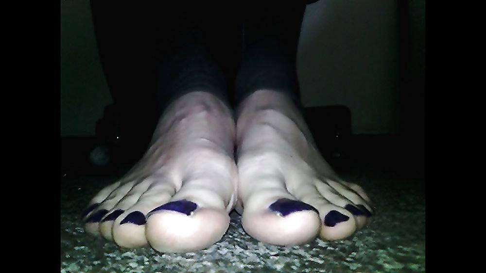 20P Blue toenails