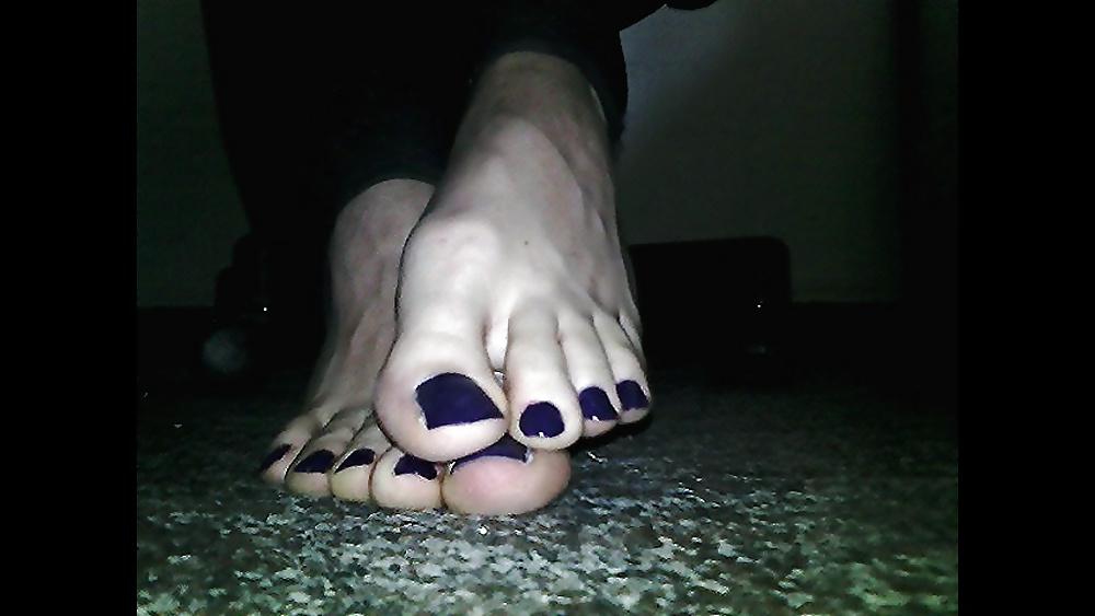 20P Blue toenails