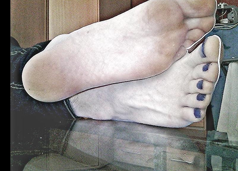 20P Blue toenails