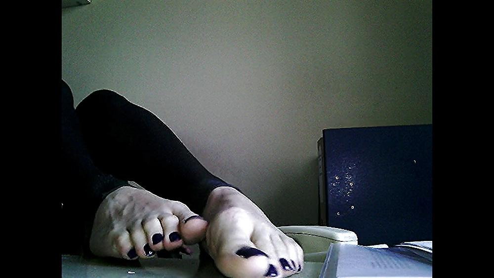 20P Blue toenails