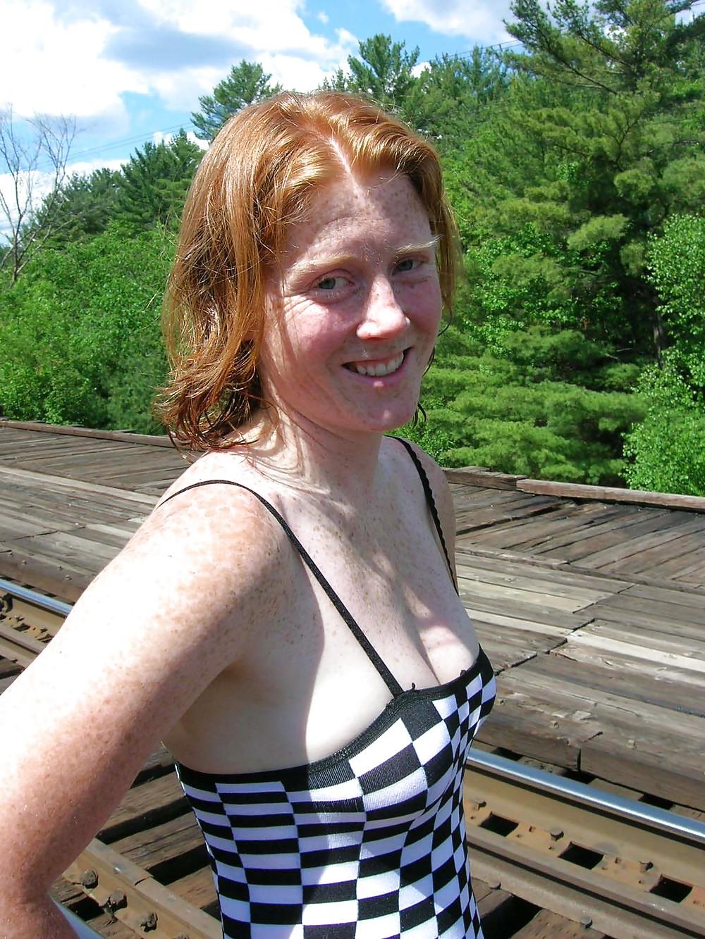 25P Girls with freckles