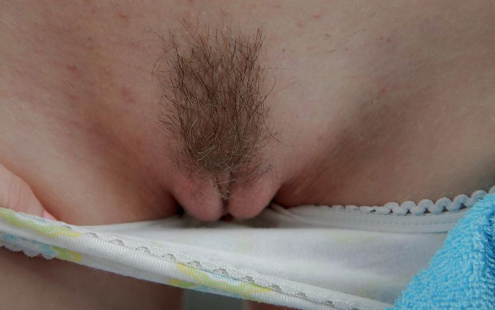 25P From the Moshe Files: Show Us Your Hairy Beaver