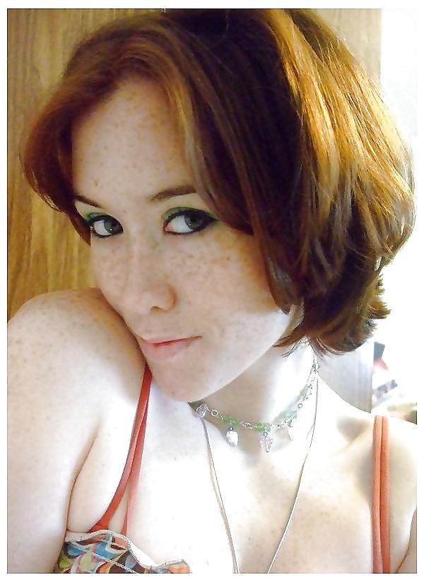 25P Freckles Love Them
