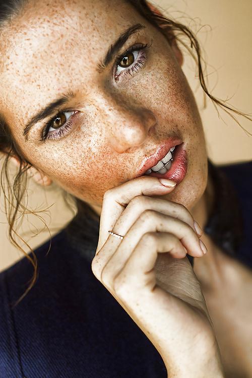 25P .:. Freckles .:.