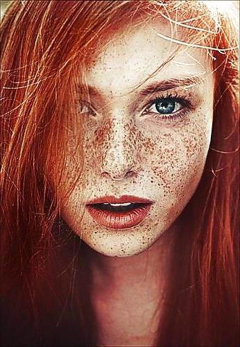 25P .:. Freckles .:.