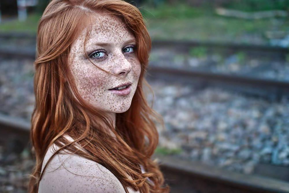 25P .:. Freckles .:.