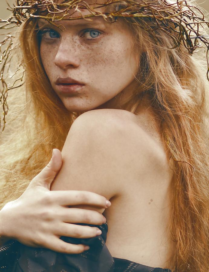 25P .:. Freckles .:.