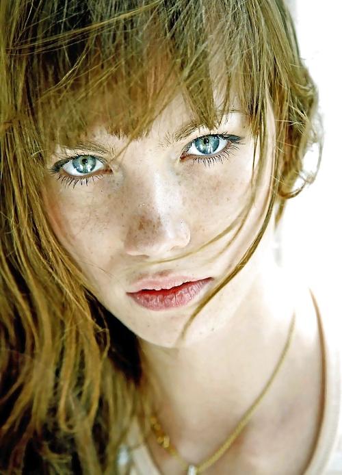 25P .:. Freckles .:.