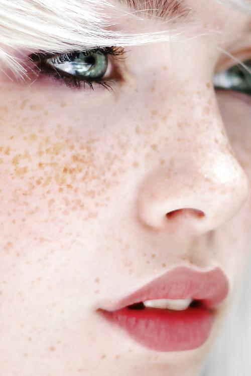 25P .:. Freckles .:.