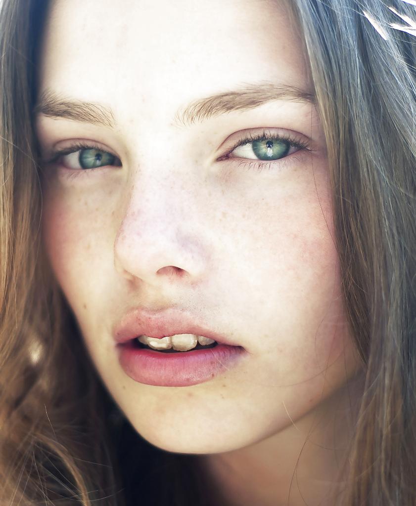 25P .:. Freckles .:.