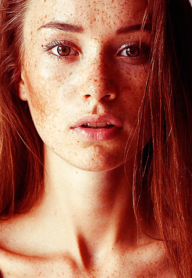 25P .:. Freckles .:.