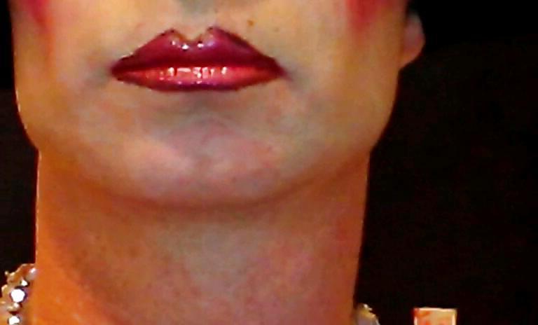 25P SHINEY LIPSTICK LIPS NEED TO SUCK DICK