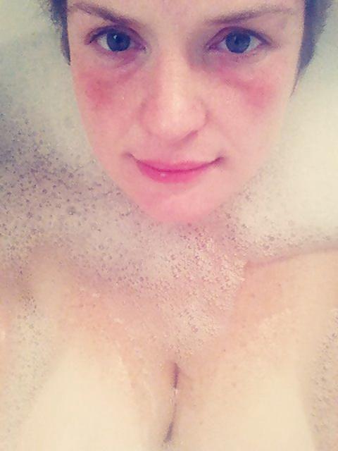 25P Freckles hers are incredible Vol 1