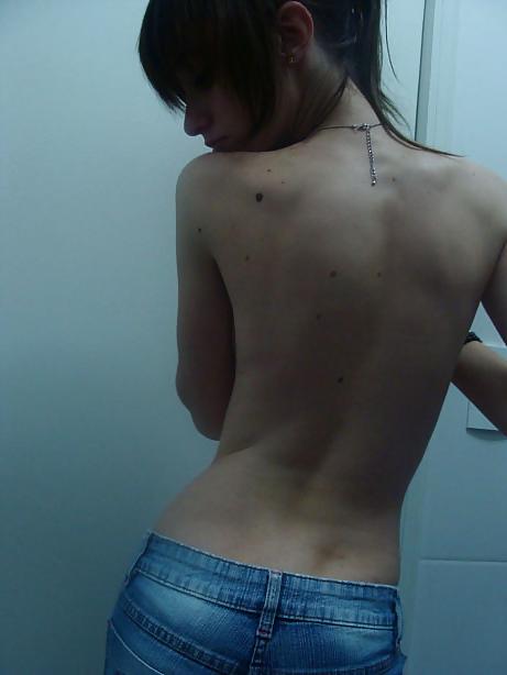 25P Awesome Redheads Girl With Freckles