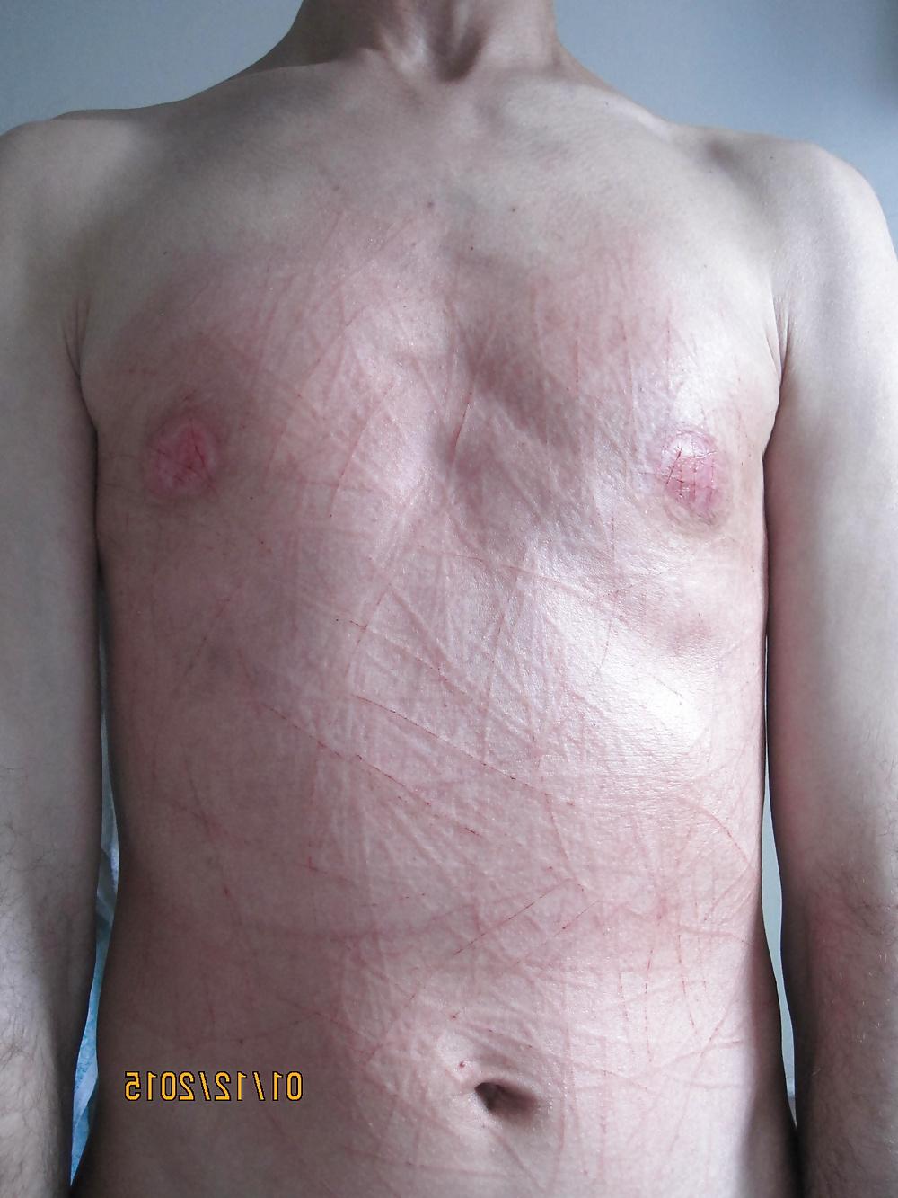 25P Tits in pain