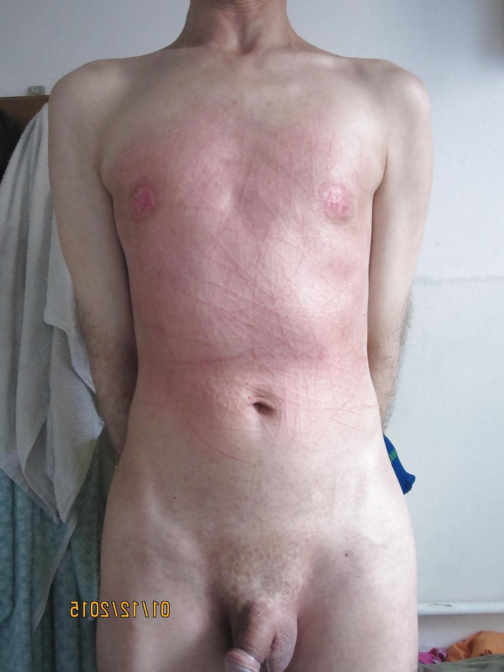 25P Tits in pain