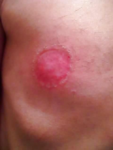 25P Tits in pain
