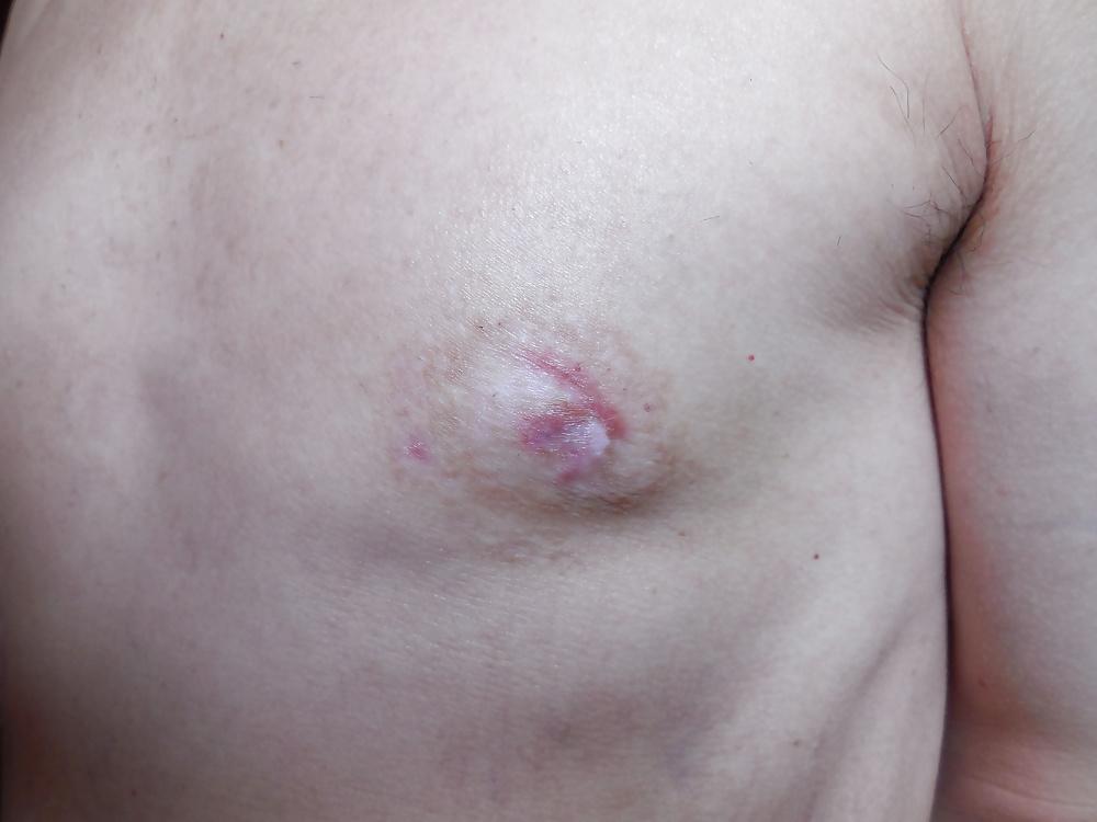 25P Tits in pain