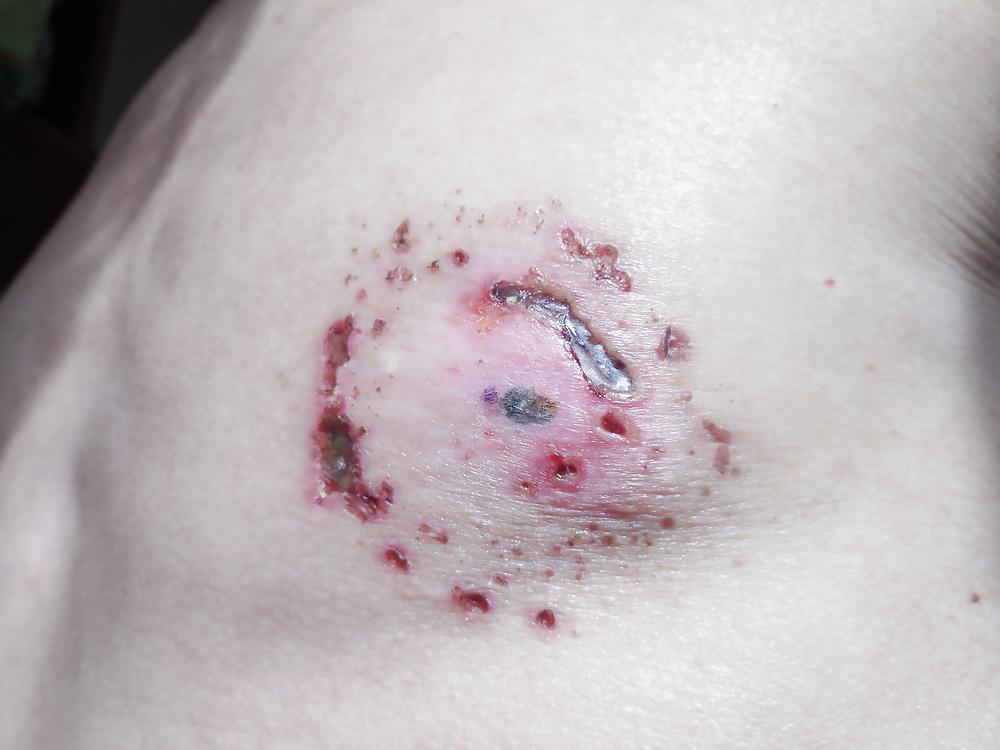 25P Tits in pain