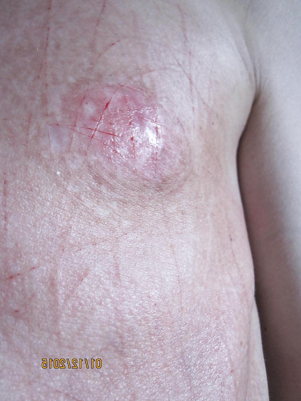 25P Tits in pain