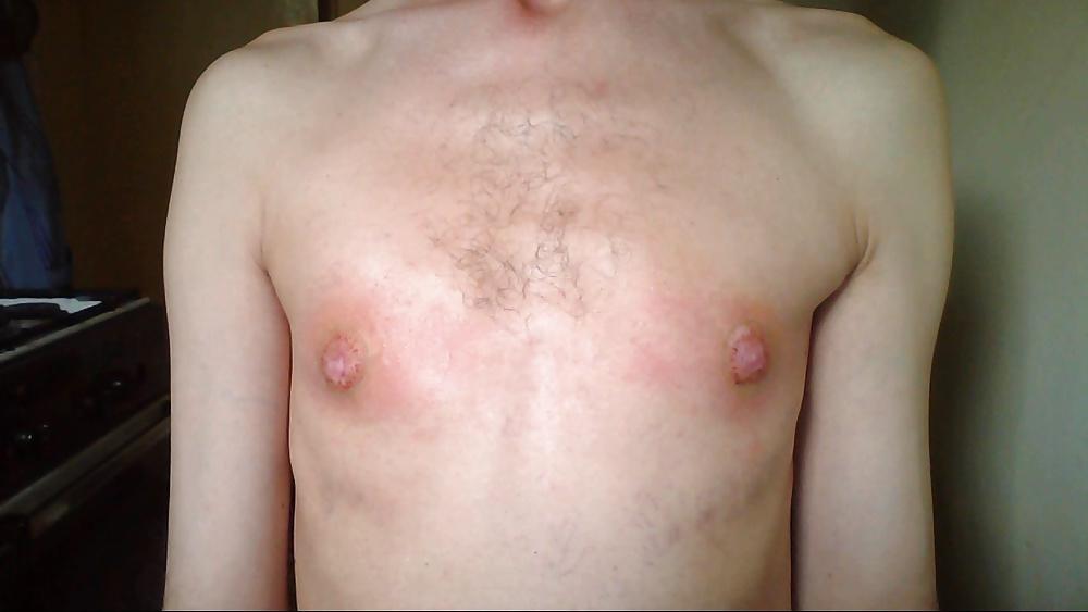 25P Tits in pain