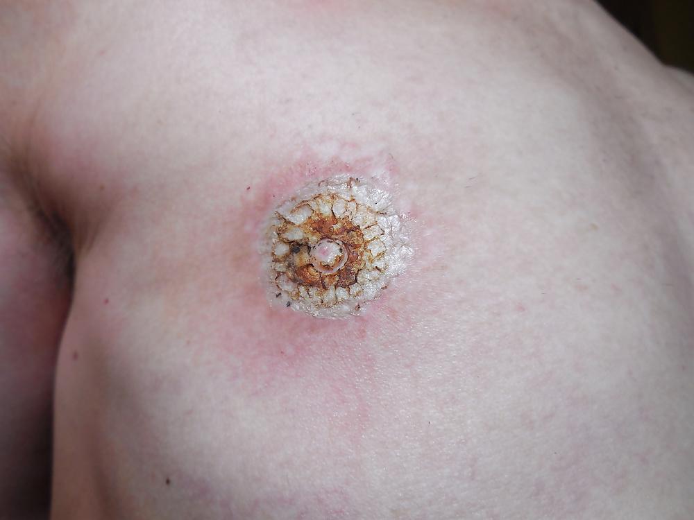 25P Tits in pain